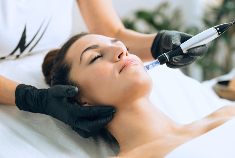 Discover the Magic of Microneedling: Rejuvenate Your Skin at PURE Holistic Beauty